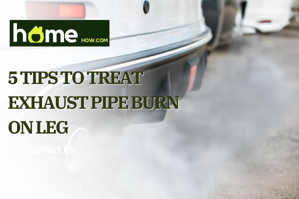 5 Tips To Treat Exhaust Pipe Burn On Leg